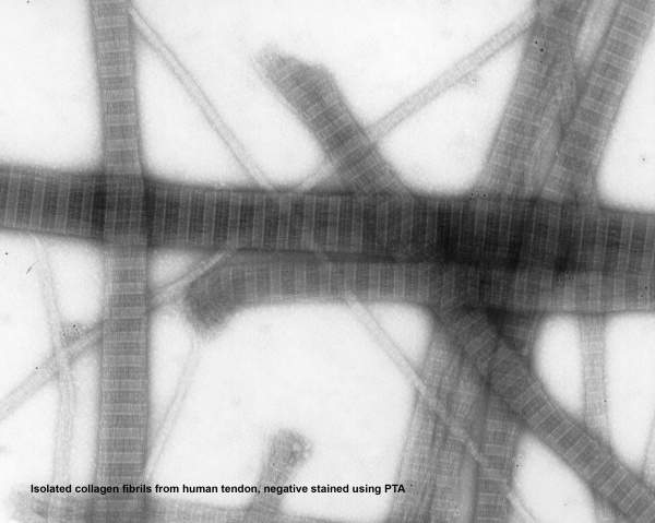 Close-up microscopic view of a plant stem